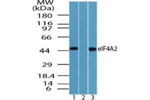 Image no. 2 for anti-Eukaryotic Translation Initiation Factor 4A2 (EIF4A2) (AA 1-50) antibody (ABIN960157) (EIF4A2 Antikörper  (AA 1-50))