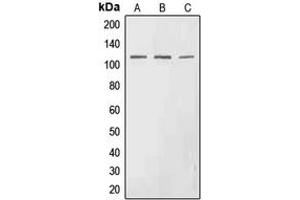 Western blot analysis of EPHA3 (pY602) expression in HEK293T (A), SP2/0 (B), H9C2 (C) whole cell lysates.