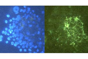Immunocytochemistry staining of tenascin C in U-87 MG cells using purified mouse monoclonal antibody T2H7 (concentration in sample 12 μg/mL, GAM FITC, right picture) vs. (TNC Antikörper)