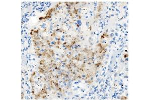 IHC analysis of ATG4A using anti-ATG4A antibody (ABIN7603108). (ATG4A Antikörper  (N-Term))