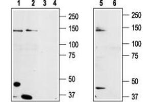 Western blot analysis of prostate carcinoma cell lines DU145 (lanes 1 and 3), Human LNCaP prostate carcinoma (lanes 2 and 4) and mouse-TRPM8 transfected HEK-293 (lanes 5 and 6) cell lysates: - 1,2,5. (TRPM8 Antikörper  (3rd Extracellular Loop))