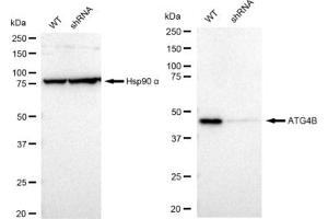 Western blotting analysis using ATG4B antibody (ABIN7797710).