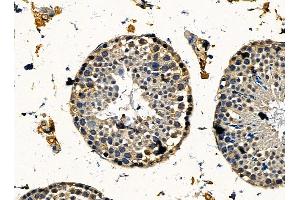 ABIN7095421 and ABIN7099478 at 1/100 staining mouse testis tissue by IHC-P.