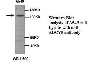 Image no. 1 for anti-Adenylate Cyclase 9 (ADCY9) antibody (ABIN1574484) (ADCY9 Antikörper)