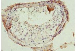 Immunohistochemistry of paraffin-embedded human testis tissue using ABIN7165308 at dilution of 1:100 (DR1 Antikörper  (AA 1-176))