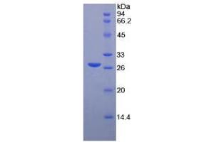 SDS-PAGE (SDS) image for Matrix Metalloproteinase 2 (MMP2) ELISA Kit (ABIN6730864)