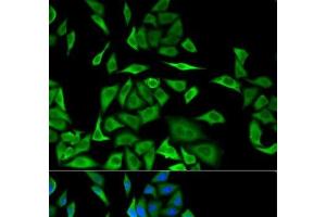 Immunofluorescence analysis of MCF-7 cells using DBI Polyclonal Antibody (Diazepam Binding Inhibitor Antikörper)