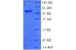 Zinc Finger Protein 592 (ZNF592) (AA 1-242), (partial) protein (GST tag) (ZNF592 Protein (AA 1-242, partial) (GST tag))