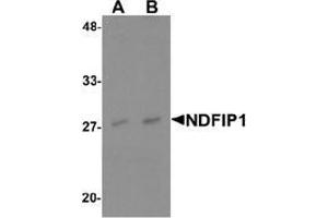 Western blot analysis of NDFIP1 in PC-3 cell lysate with NDFIP1 Antibody  at (A) 0. (NDFIP1 Antikörper  (N-Term))