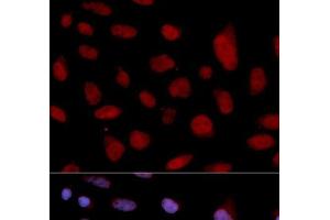 Immunofluorescence analysis of U2OS cells using TNNC1 Polyclonal Antibody (TNNC1 Antikörper)