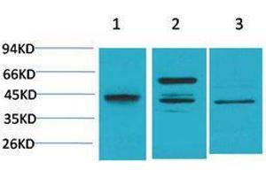 Western Blotting (WB) image for anti-Caspase 8 (CASP8) antibody (ABIN3188046)