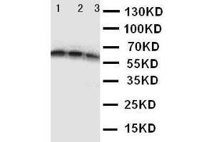 Anti-CD40 antibody,  Western blotting Lane 1: Recombinant Human CD40 Protein 10ng Lane 2: Recombinant Human CD40 Protein 5ng Lane 3: Recombinant Human CD40 Protein 2. (CD40 Antikörper  (N-Term))