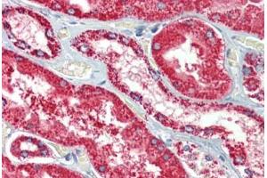 Kidney, Human: Formalin-Fixed, Paraffin-Embedded (FFPE) (HSPD1 Antikörper)