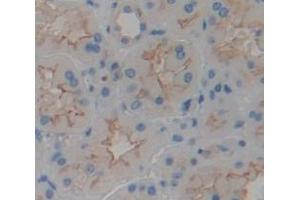 IHC-P analysis of Human Tissue, with DAB staining. (TMEM27 Antikörper  (AA 17-137))