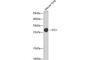 Western blot analysis of extracts of mouse lung, using STC1 Antibody (ABIN6128750, ABIN6148585, ABIN6148586 and ABIN6222488) at 1:1000 dilution. (Stanniocalcin 1 Antikörper  (AA 18-247))