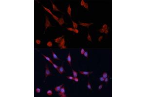 Immunofluorescence analysis of NIH-3T3 cells using DD Polyclonal Antibody (ABIN6127748, ABIN6139455, ABIN6139456 and ABIN6214493) at dilution of 1:100 (40x lens). (DDAH1 Antikörper  (AA 1-285))