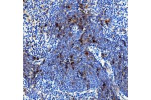 IHC analysis of IL4R using anti-IL4R antibody (ABIN7600970).