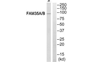 Western blot analysis of extracts from Jurkat cells, using FAM35A/B antibody. (FAM35A/B (Internal Region) Antikörper)