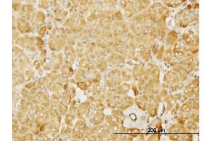 Immunoperoxidase of monoclonal antibody to WASL on formalin-fixed paraffin-embedded human pancreas. (Neural Wiskott-Aldrich syndrome protein (WASL) (AA 97-184) Antikörper)