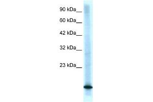 Western Blotting (WB) image for anti-Cyclin-Dependent Kinase Inhibitor 2B (p15, Inhibits CDK4) (CDKN2B) (Middle Region) antibody (ABIN2774603)
