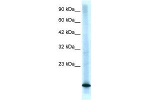 WB Suggested Anti-CDKN2B Antibody Titration:  0. (CDKN2B Antikörper  (Middle Region))