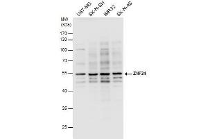 WB Image ZNF24 antibody detects ZNF24 protein by western blot analysis. (ZNF24 Antikörper)