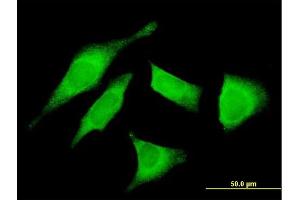 Immunofluorescence of monoclonal antibody to UTRN on HeLa cell.