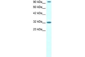 WB Suggested Anti-CIC Antibody Titration:  1. (CIC Antikörper  (N-Term))