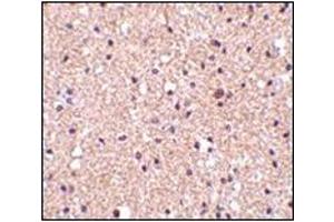 Immunohistochemistry of op18 in human brain tissue with this product at 2. (Stathmin 1 Antikörper  (C-Term))