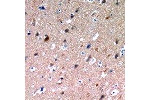 Immunohistochemical analysis of NLRX1 staining in human brain formalin fixed paraffin embedded tissue section. (NLRX1 Antikörper)