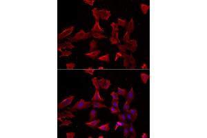 Immunofluorescence analysis of HeLa cells using ADSS antibody (ABIN6131467, ABIN6136604, ABIN6136606 and ABIN6216015).
