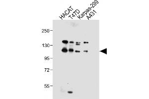 All lanes : Anti-RN2 Antibody (C-term) at 1:1000 dilution Lane 1: HACAT whole cell lysate Lane 2: T47D whole cell lysate Lane 3: Karpas-299 whole cell lysate Lane 4: A431 whole cell lysate Lysates/proteins at 20 μg per lane. (MMRN2 Antikörper  (C-Term))