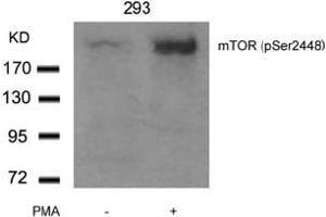 Image no. 3 for anti-Mechanistic Target of Rapamycin (serine/threonine Kinase) (mTOR) (pSer2448) antibody (ABIN196963) (MTOR Antikörper  (pSer2448))