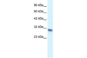 Western Blot showing FHL2 antibody used at a concentration of 1-2 ug/ml to detect its target protein.