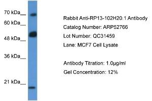 Western Blotting (WB) image for anti-rho GTPase Activating Protein 36 (ARHGAP36) (N-Term) antibody (ABIN406257) (ARHGAP36 Antikörper  (N-Term))