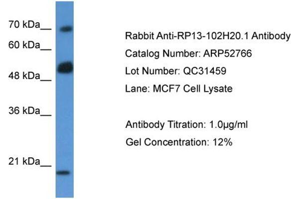 ARHGAP36 antibody  (N-Term)