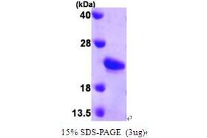 SDS-PAGE (SDS) image for Sonic Hedgehog (SHH) (AA 25-198) protein (His tag) (ABIN666981) (Sonic Hedgehog Protein (SHH) (AA 25-198) (His tag))