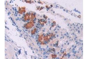 Immunohistochemistry (IHC) image for anti-Oncostatin M (OSM) (AA 116-205) antibody (ABIN7438130)