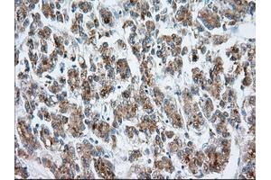 Immunohistochemical staining of paraffin-embedded prostate tissue using anti-MTRF1L mouse monoclonal antibody.