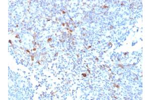 Formalin-fixed, paraffin-embedded human Lymph Node stained with TRAF1 Mouse Monoclonal Antibody (TRAF1/2770). (TRAF1 Antikörper  (AA 73-219))