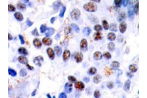 Image no. 3 for anti-Jun Proto-Oncogene (JUN) antibody (ABIN265356)