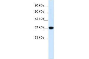 WB Suggested Anti-ZBTB32 Antibody Titration: 0. (ZBTB32 Antikörper  (N-Term))