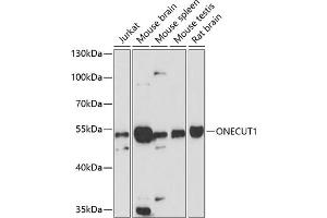 Western blot analysis of extracts of various cell lines, using ONECUT1 antibody (ABIN6132821, ABIN6145027, ABIN6145029 and ABIN6216522) at 1:3000 dilution. (ONECUT1 Antikörper  (AA 167-292))