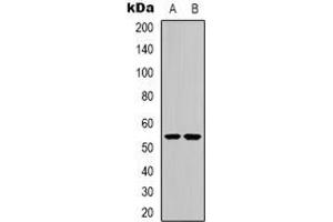 Western blot analysis of CHRNA9 expression in Jurkat (A), HEK293T (B) whole cell lysates.