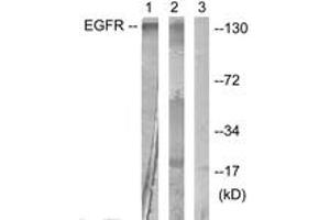 Western blot analysis of extracts from HuvEc cells, treated with Serum 20% 30', using EGFR (Ab-1016) Antibody. (EGFR Antikörper  (AA 986-1035))