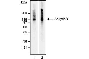 Western blot analysis of Ankyrin B. (ANK2 Antikörper)