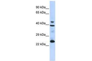 Image no. 1 for anti-Selenoprotein P (SEPP1) (AA 35-84) antibody (ABIN6743265) (Selenoprotein P Antikörper  (AA 35-84))