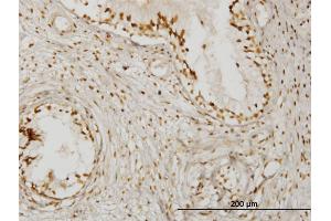 Immunoperoxidase of monoclonal antibody to KLHDC4 on formalin-fixed paraffin-embedded human prostate. (KLHDC4 Antikörper  (AA 1-463))