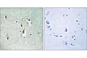 Immunohistochemistry (IHC) image for anti-Cyclin D1 (CCND1) (AA 246-295) antibody (ABIN2888623) (Cyclin D1 Antikörper  (AA 246-295))