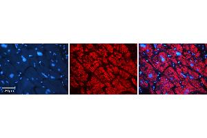 Rabbit Anti-AKR1B1 Antibody Catalog Number: ARP48179_P050 Formalin Fixed Paraffin Embedded Tissue: Human heart Tissue Observed Staining: Cytoplasmic Primary Antibody Concentration: N/A Other Working Concentrations: 1:600 Secondary Antibody: Donkey anti-Rabbit-Cy3 Secondary Antibody Concentration: 1:200 Magnification: 20X Exposure Time: 0. (AKR1B1 Antikörper  (N-Term))